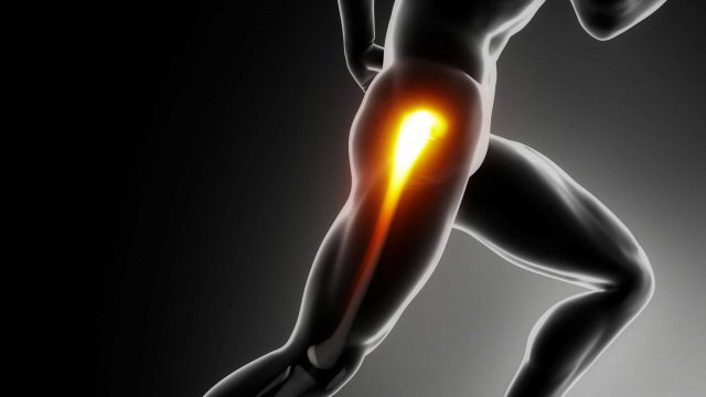 Gluteal Tendinopathy